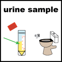 illustration of urine sample